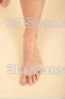 Photo reference of foot 0003